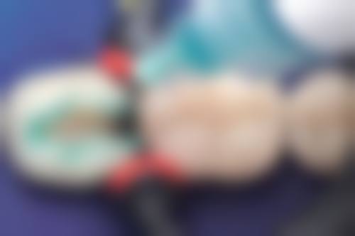 总结