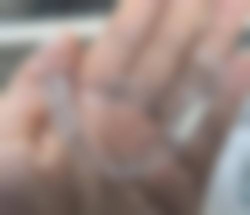 湖北宜昌五峰牙立佳口腔常见问题FAQ
