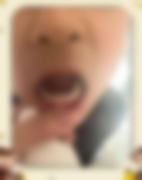 总结