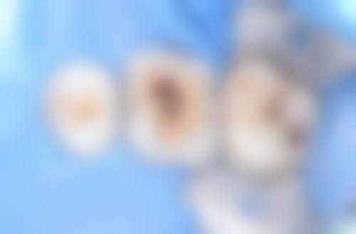 广东东莞寮步博朗口腔门诊部常见问题FAQ