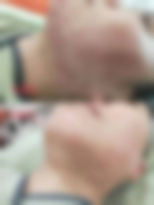 陕西中 医 药大学第二附属医院(皮肤整形科)常见问题FAQ