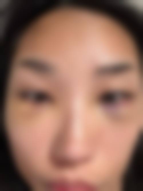 2026郑州爱美汇医疗美容诊所价格表(仅供参考)
