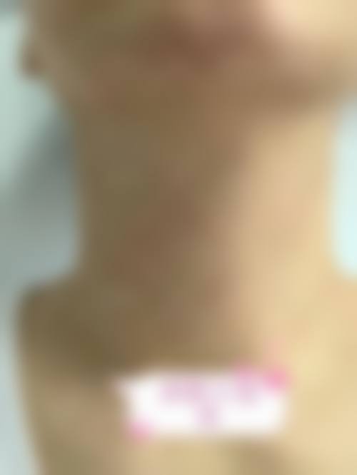 总结
