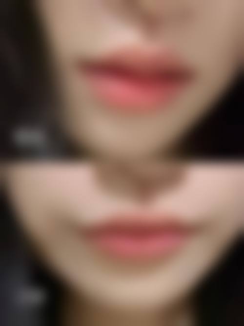 郑州爱美汇医疗美容诊所擅长项目