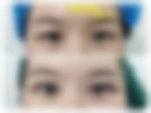 2026山东省千佛山医院整形外科价格表(仅供参考)