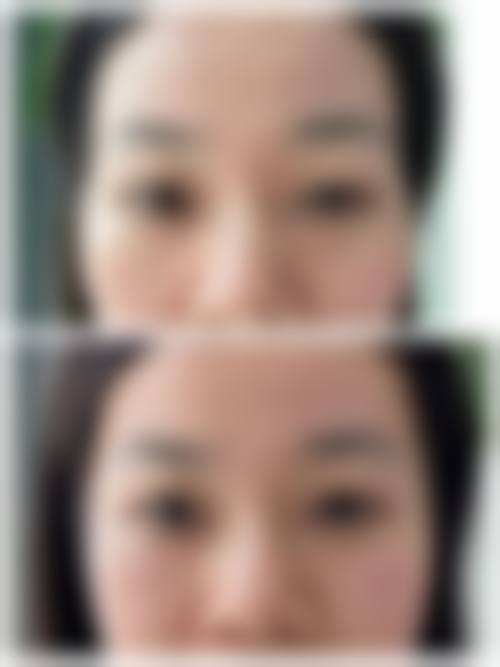 2026山东美莱整形美容医院价格表（仅供参考）