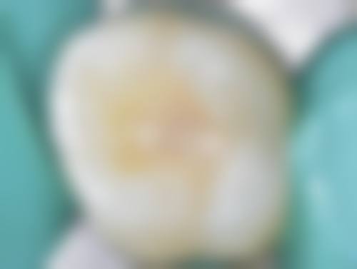 总结
