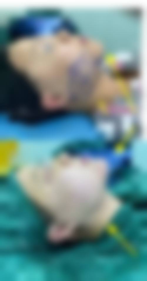兰溪市人民医院整形烧伤外科怎么预约？