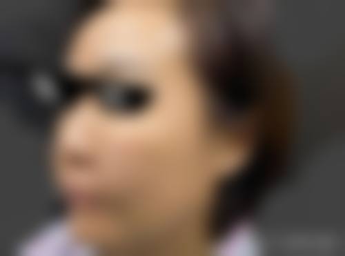 山东美莱整形美容医院怎么预约？