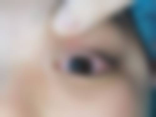 南通如东文慈眼科医院怎么预约？