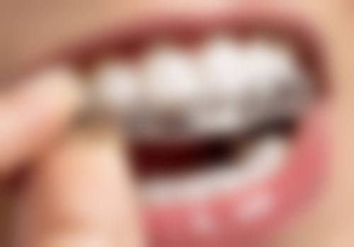 杭州优典口腔门诊部常见问题FAQ