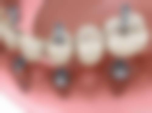 成都皓雅口腔门诊部常见问题FAQ