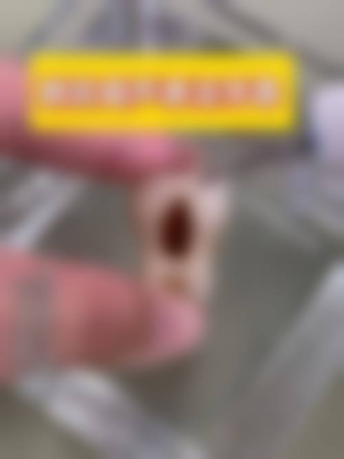 总结