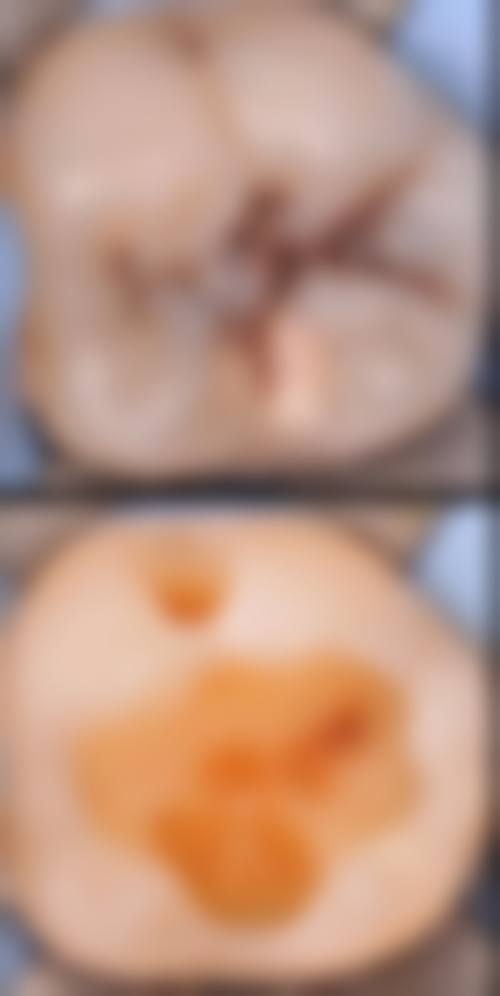 总结