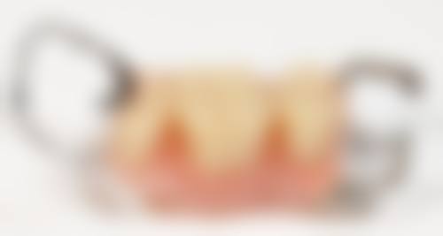 江苏淮安雅洁口腔怎么预约?