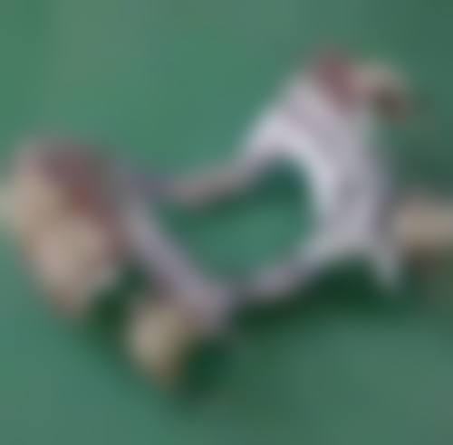 广东东莞伯尔口腔擅长项目