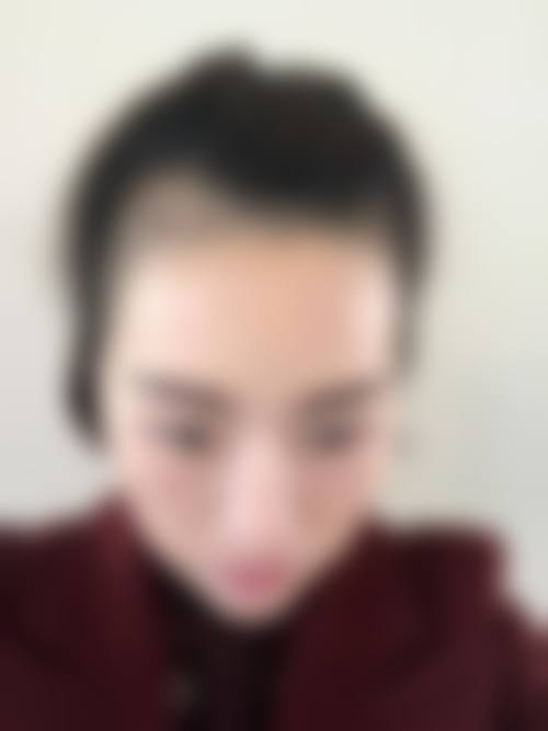 东莞新生植发医疗美容门诊部怎么预约?