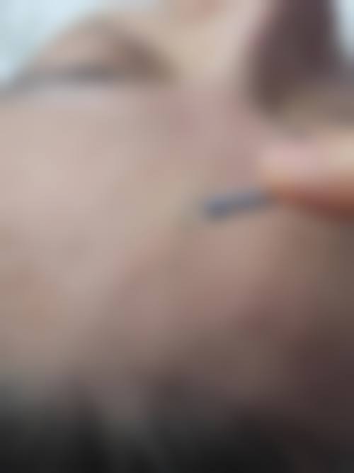 总结