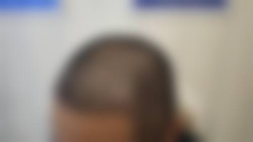 东莞新生植发医疗美容门诊部常见问题FAQ