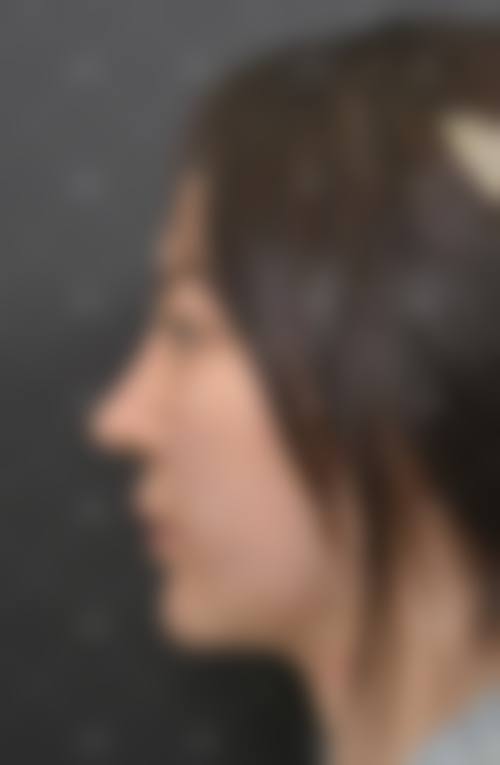 总结