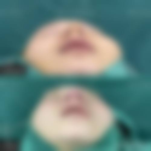 深圳刘运奇医疗美容医院擅长项目