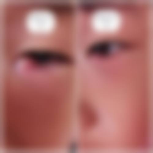总结