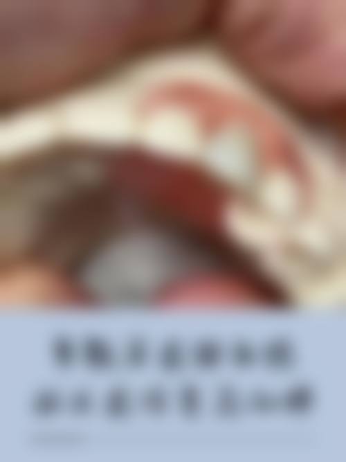 总结