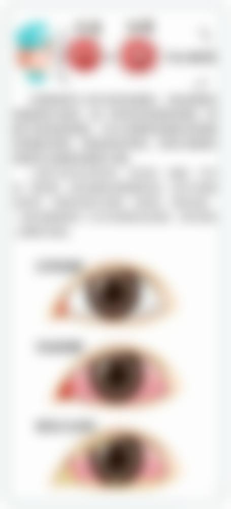 湘西土家族苗族自治州人民医院眼科常见问题FAQ