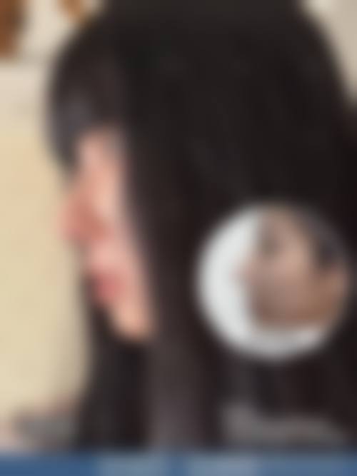 皖南医学校第二附属医院整形美容科常见问题FAQ