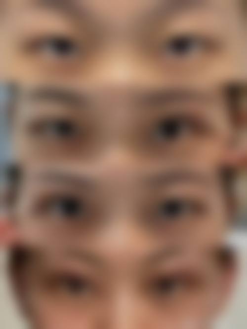 合肥市第二人民医院整形美容科怎么预约？