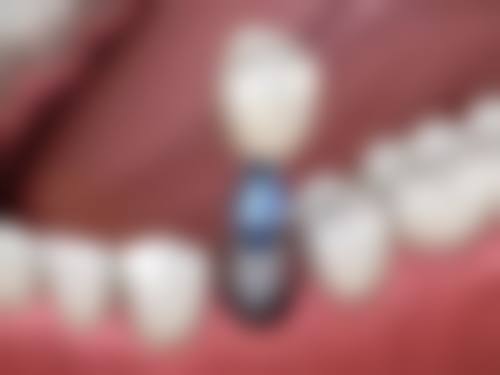 吉林省前卫医院口腔科常见问题FAQ