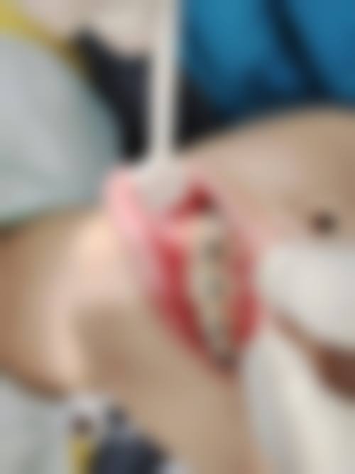 总结