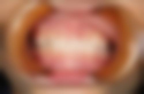 总结