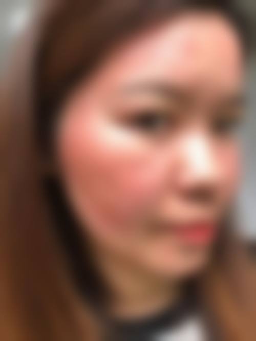 威海正源整形美容医院如何怎么预约？