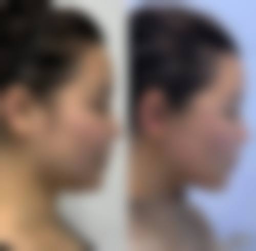 西安丽樽医疗整形美容医院常见问题FAQ