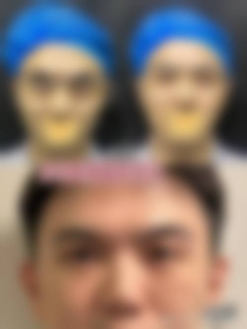 武汉壹加壹医疗美容医院(华中旗舰店)常见问题FAQ