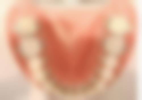 总结