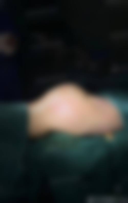 总结