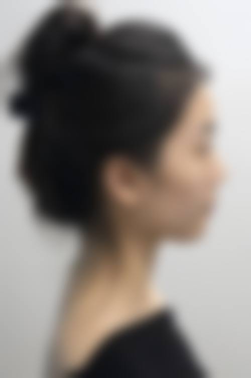 2026长沙华美医学整形美容医院价格表(仅供参考)