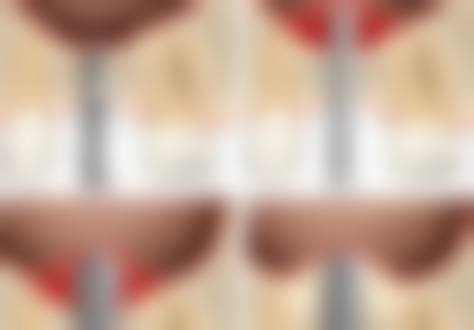 东莞虎门虎跃凡享口腔常见问题FAQ