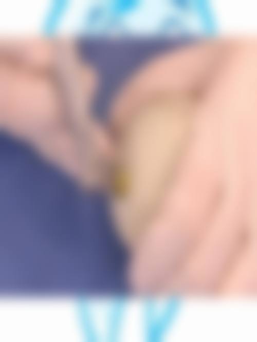 东莞虎门虎跃凡享口腔擅长项目