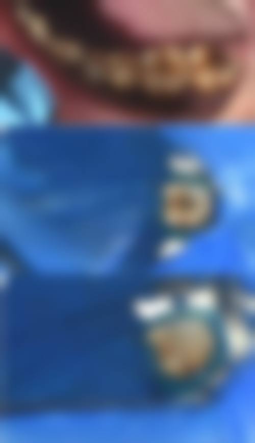 总结