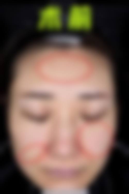 总结