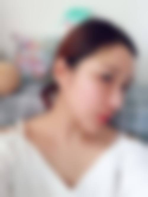合肥惠更美整形医院擅长项目