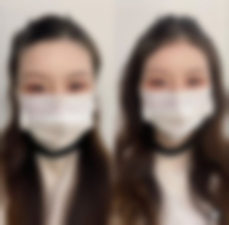 2026昆明熙美医疗美容门诊部(原都市俪人)价格表(仅供参考)