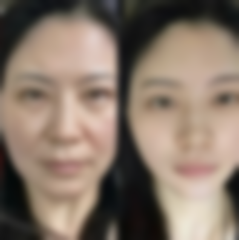 长沙华美医学整形美容医院常见问题FAQ