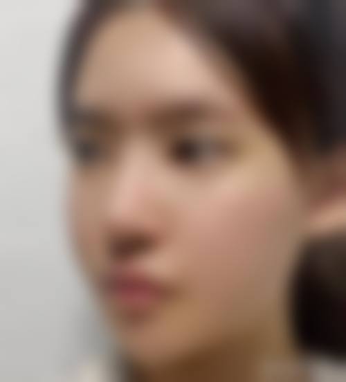 海口美兰红妆双美安信整形医院常见问题FAQ