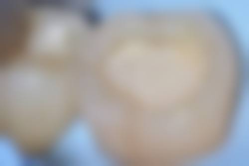总结