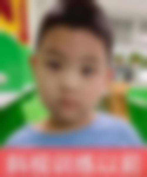 厦门医学校附属第二医院眼科常见问题FAQ