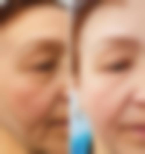 总结